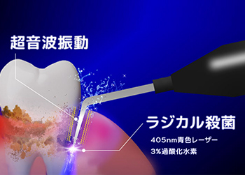高い殺菌効果・特殊な超音波振動