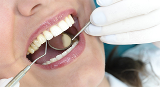 定期的に入れ歯状態の確認のため、歯科医院へご来院ください