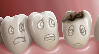 理由　03　虫歯や歯周病のリスクを抑える